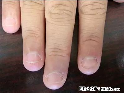 剪指甲、挖耳屎，这些日常小动作竟隐藏大危害！ - 濮阳生活资讯 - 濮阳28生活网 puyang.28life.net